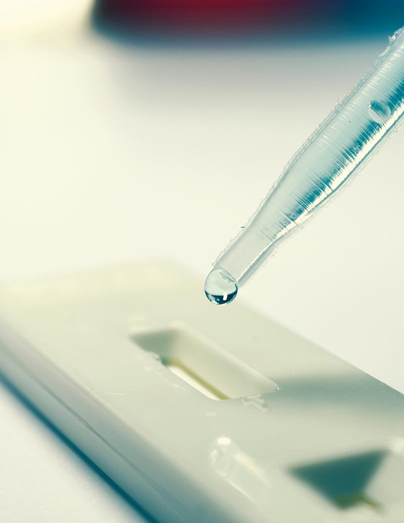 Global rapid diagnostics market 2024-2028
