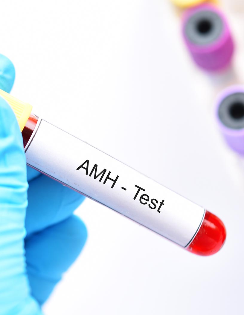 Global male hypogonadism market 2024-2028
