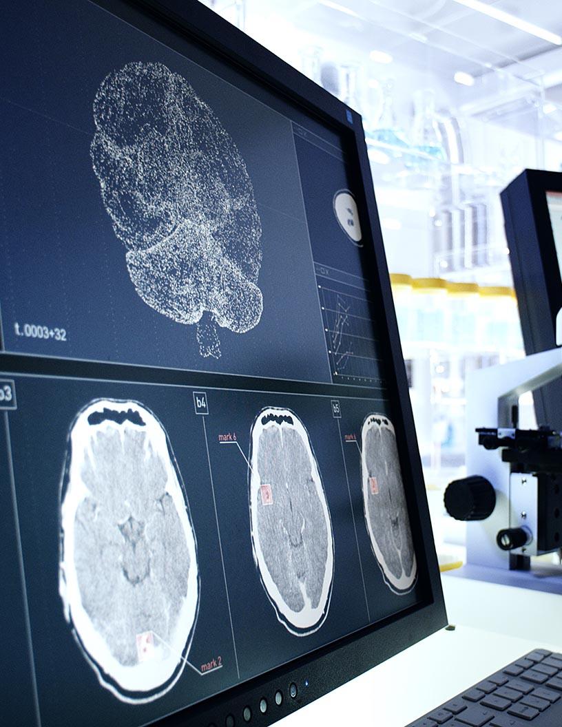 Global neurodegenerative diseases therapeutics market 2024-2028