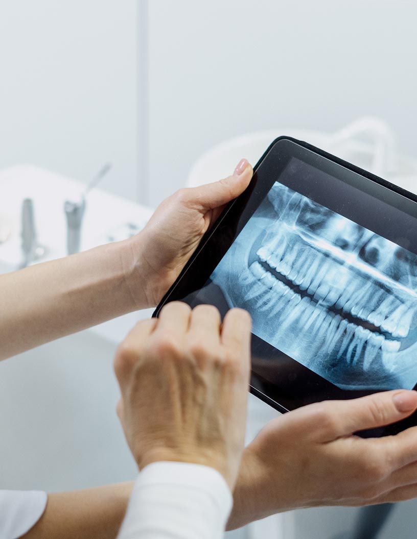 Global dental Implant abutment systems market 2024-2028