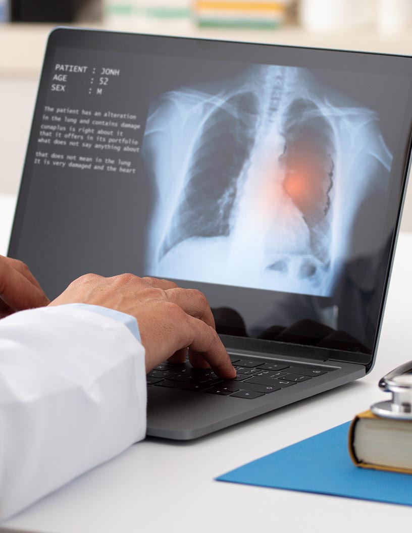 Global pulmonary edema therapeutics market 2024-2028