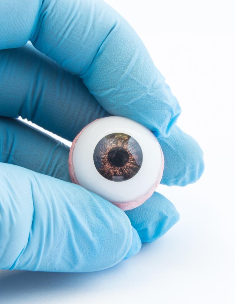 Global Artificial Eye Market 2025-2029
