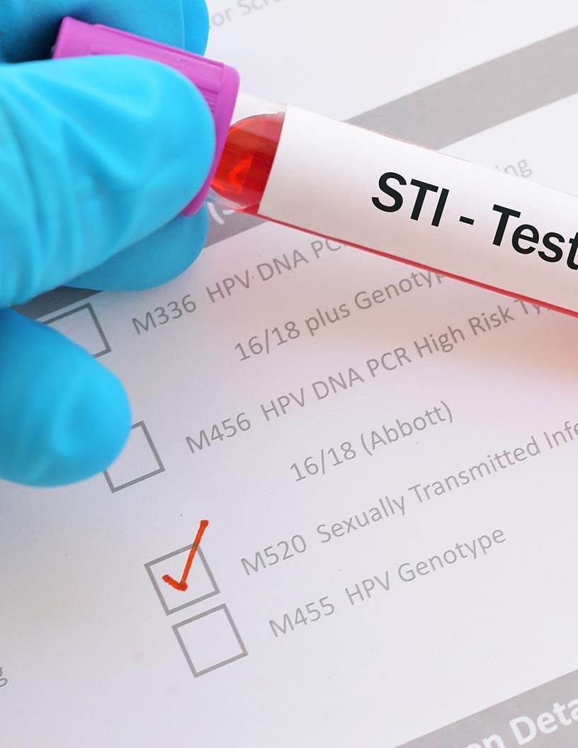 Global Sexually Transmitted Diseases (STD) Treatment Market 2025-2029