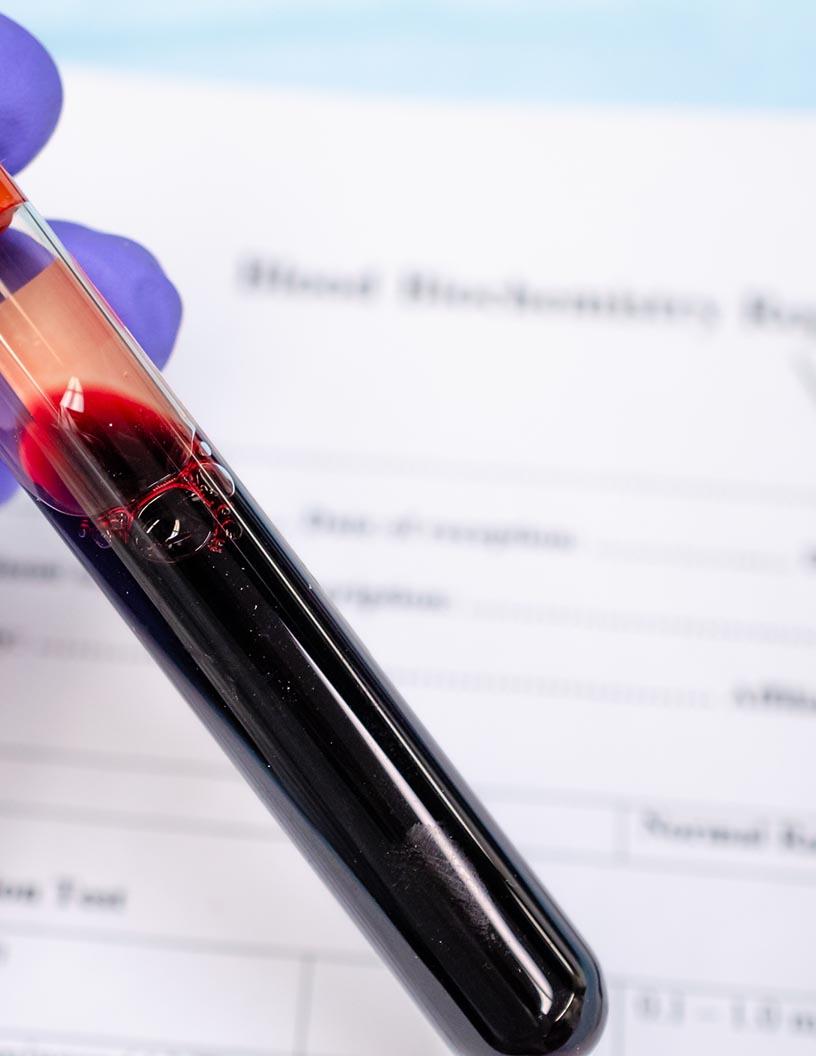 Global Blood Market 2025-2029