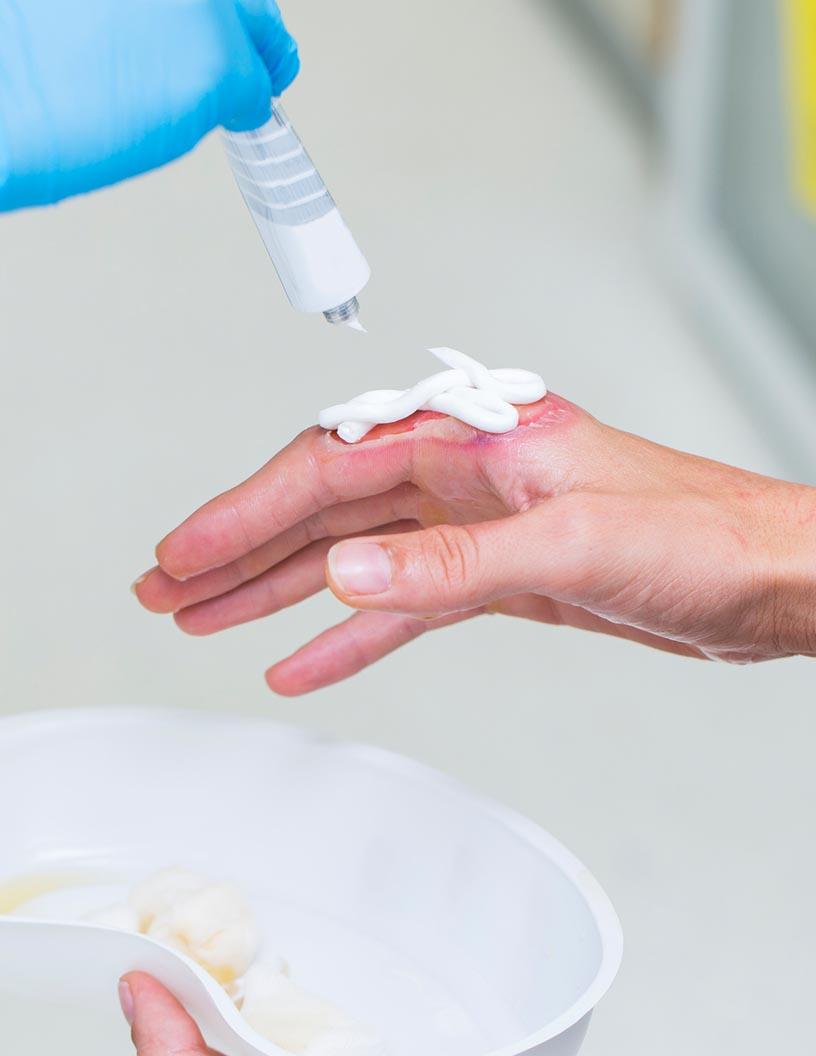Global burn care market 2024-2028