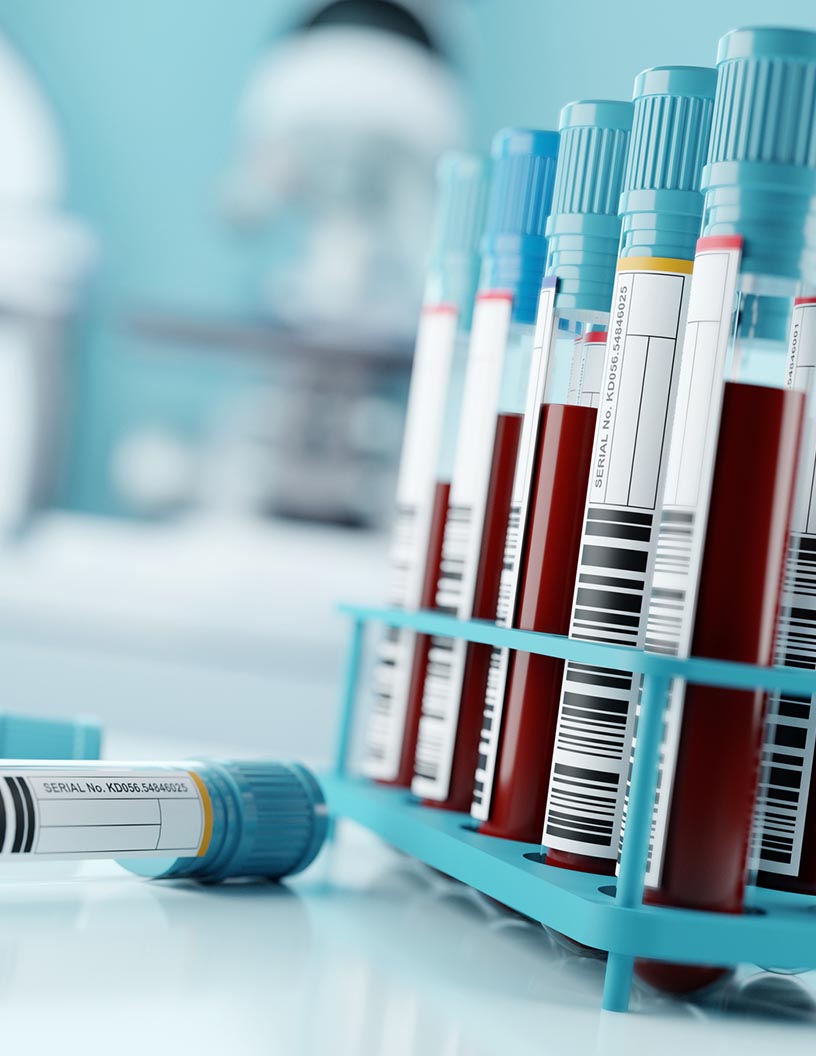 Global preeclampsia laboratory testing market 2024-2028