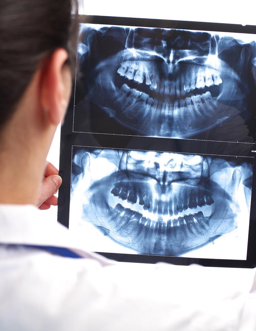 Global Dental Imaging Market 2025-2029