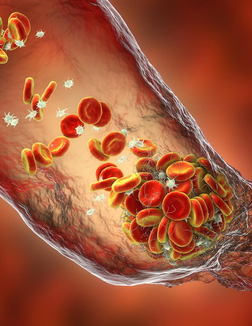 Global pulmonary arterial hypertension (PAH) drugs market 2024-2028