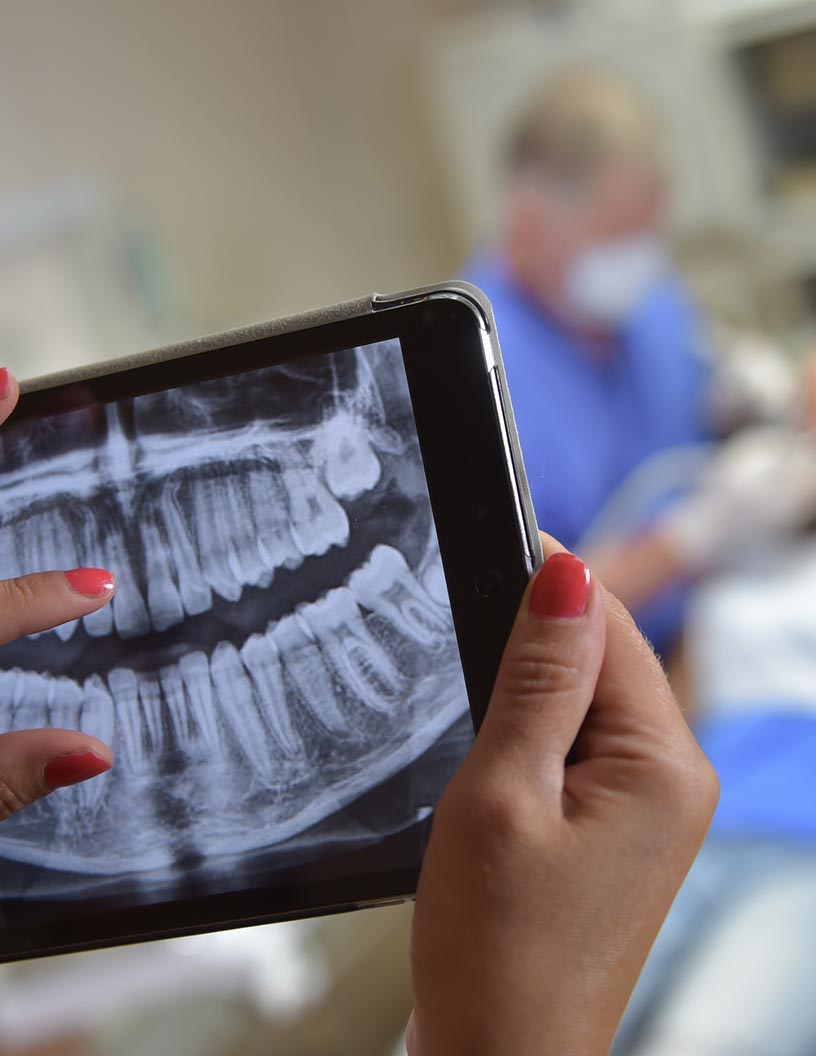 Global dental x ray market 2024-2028