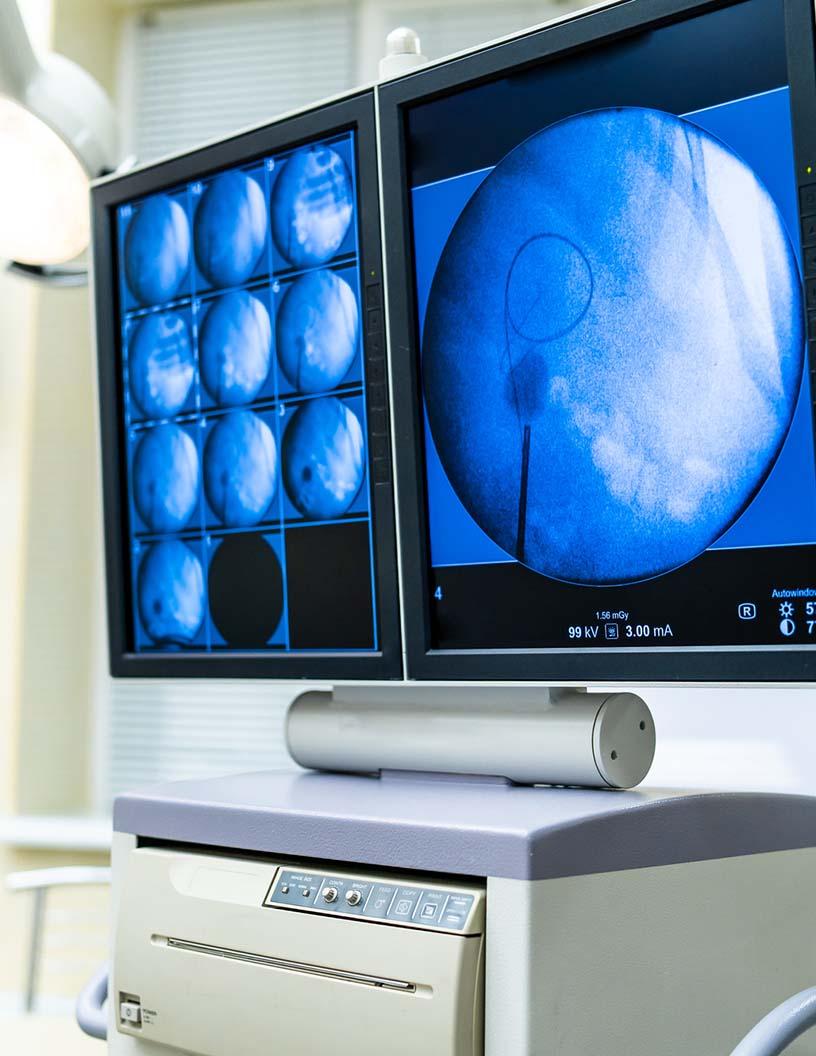 Medical Display Monitors Market in US 2025-2029
