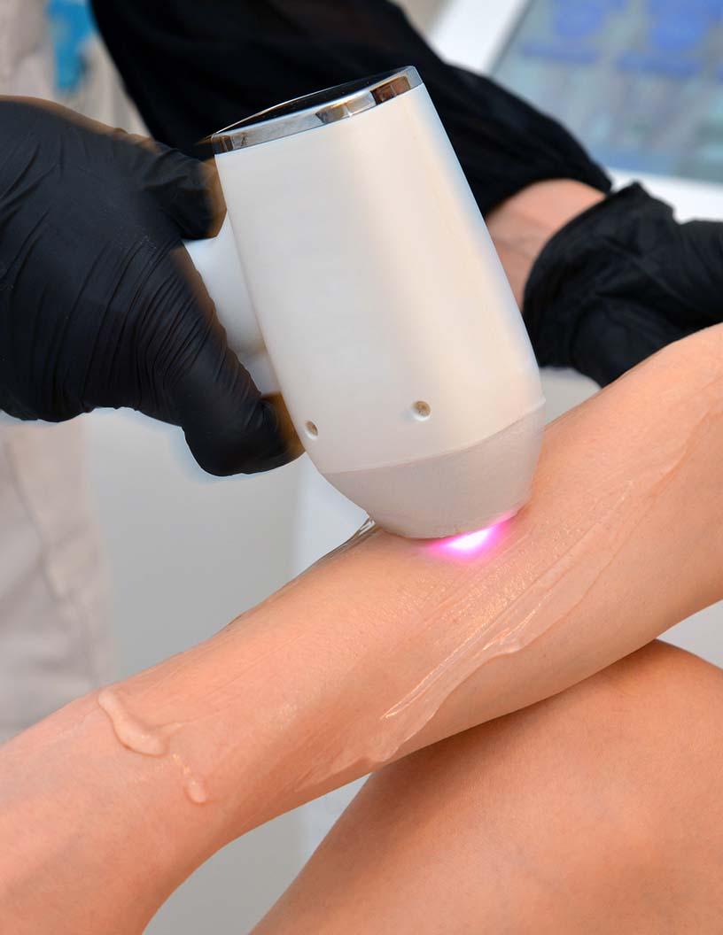 Global Aesthetic Lasers Market 2025-2029