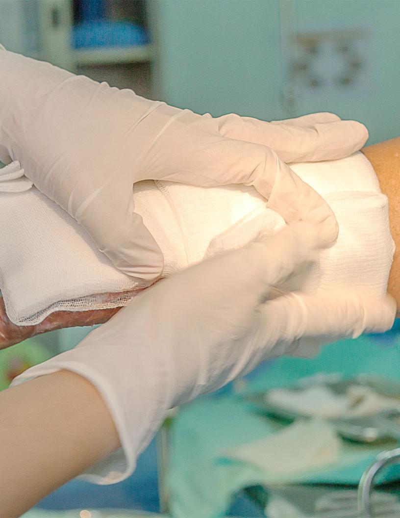 Burn Care Centers Market in US 2025-2029