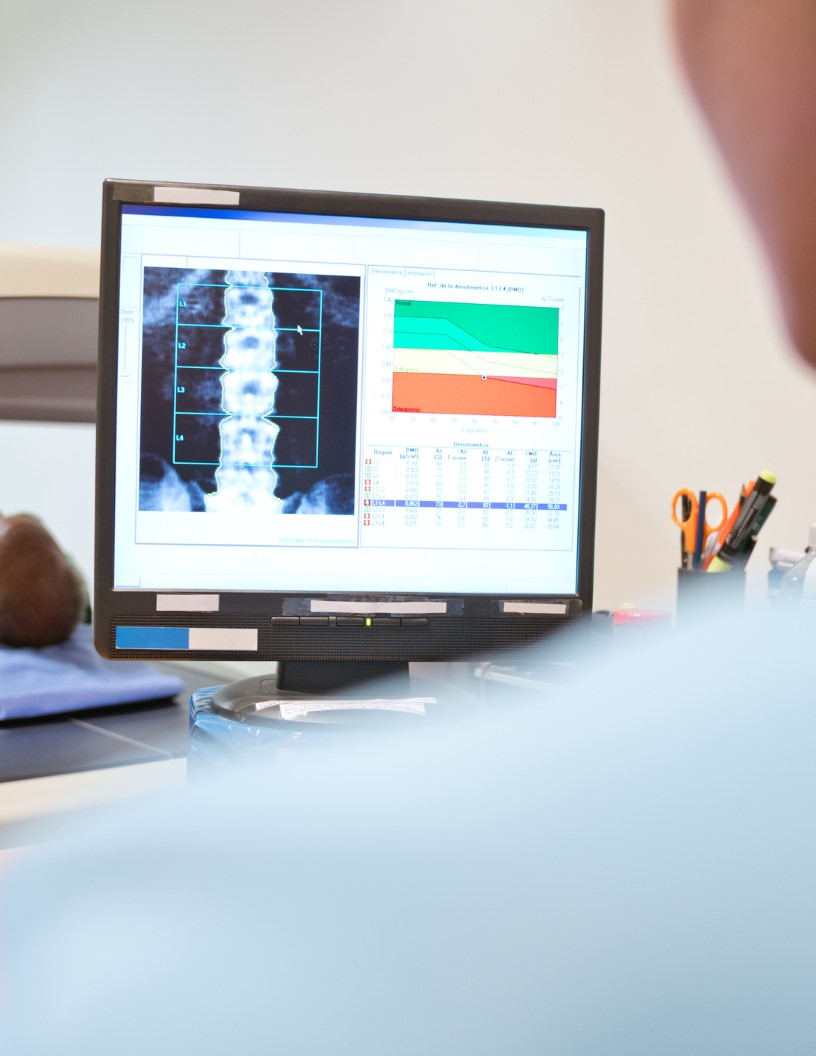 Global Bone Densitometer Market 2024-2028