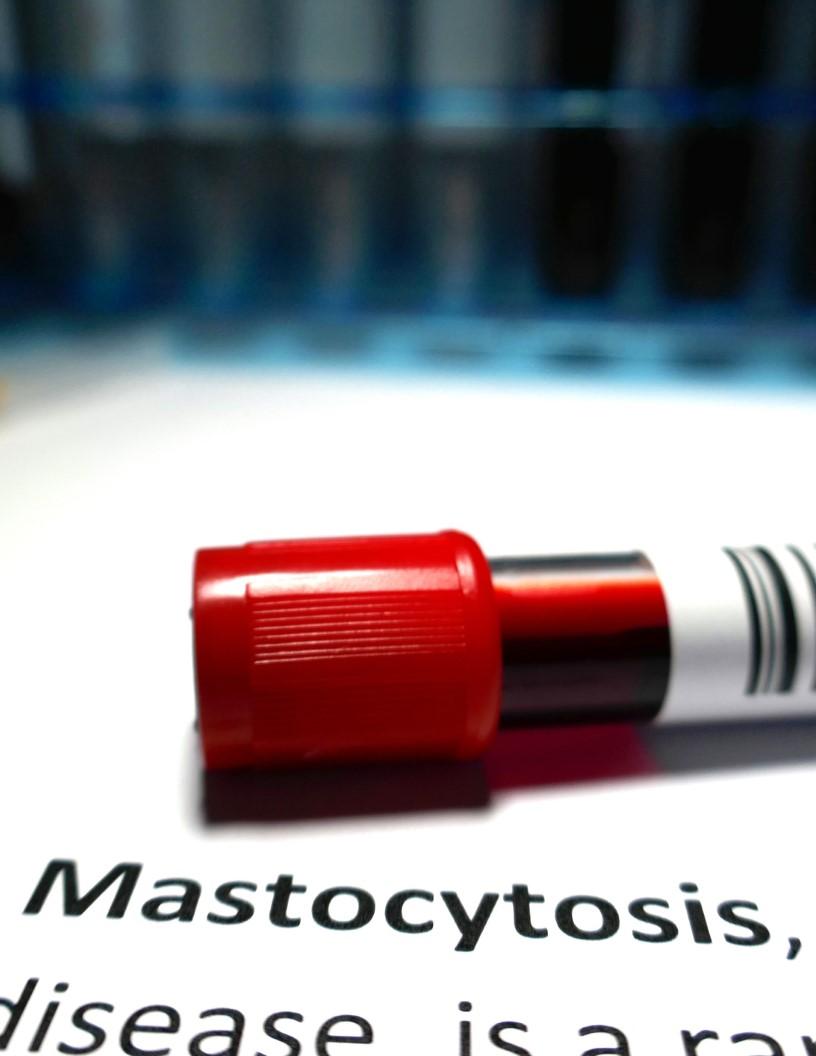 Global Systemic Mastocytosis Treatment Market 2025-2029