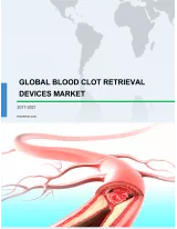 Global Blood Clot Retrieval Devices Market 2017-2021