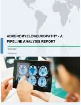 Adrenomyeloneuropathy - A Pipeline Analysis Report