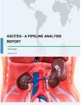Ascites - A Pipeline Analysis Report