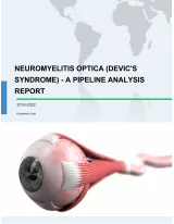 Neuromyelitis Optica (Devic's Syndrome) - A Pipeline Analysis Report