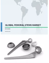 Femoral Stems Market by Fixture and Geography - Global Forecast and Analysis 2019-2023