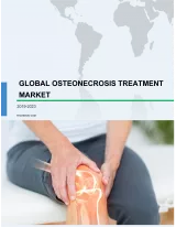 Global Osteonecrosis Therapeutics Market 2019-2023