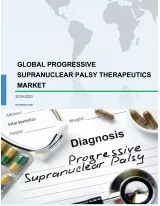 Global Progressive Supranuclear Palsy Therapeutics Market 2019-2023