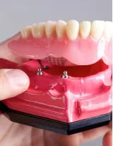 Dentures Market by Product, End-user, and Geography - Forecast and Analysis 2021-2025