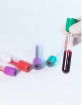 Bloodstream Infection Testing Market by Technology and Geography - Forecast and Analysis 2021-2025
