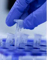 Enzymes Market by Application and Geography - Forecast and Analysis 2022-2026