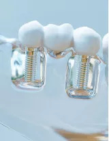 Dental Prosthetics Market by Type and Geography - Forecast and Analysis 2021-2025