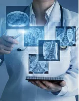 Diagnostic Imaging Market in Europe by Type and Geography - Forecast and Analysis 2022-2026