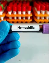 Rare Hemophilia Factors Market by Method and Geography - Forecast and Analysis 2022-2026