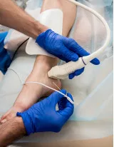 Radiofrequency Ablation Devices Market by Product and Geography - Forecast and Analysis 2022-2026
