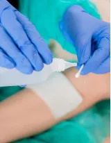 Bioactive Wound Dressing Market by Type and Geography - Forecast and Analysis 2022-2026