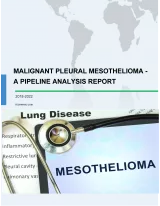 Malignant Pleural Mesothelioma - A Pipeline Analysis Report