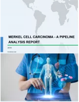 Merkel Cell Carcinoma - A Pipeline Analysis Report