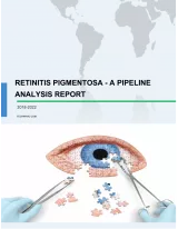 Retinitis Pigmentosa - A Pipeline Analysis Report