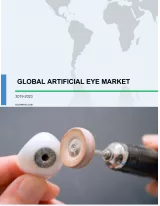 Global Artificial Eye Market 2019-2023