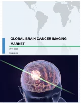 Global Brain Cancer Imaging Market 2018-2022