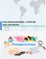 Cholangiocarcinoma - A Pipeline Analysis Report