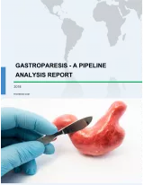 Gastroparesis - A Pipeline Analysis Report