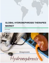 Global Hydronephrosis Drugs Market 2019-2023