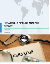 Keratitis - A Pipeline Analysis Report