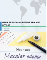 Macular Edema - A Pipeline Analysis Report