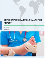 Onychomycosis - A Pipeline Analysis Report