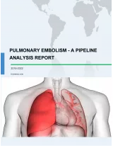 Pulmonary Embolism - A Pipeline Analysis Report