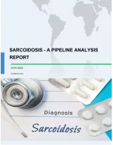 Sarcoidosis - A Pipeline Analysis Report