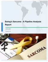 Ewing's Sarcoma - A Pipeline Analysis Report