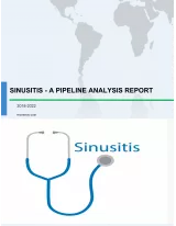 Sinusitis - A Pipeline Analysis Report