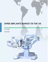 Spine Implants Market in the US 2016-2020