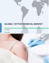 Global Tattoo Removal Market 2017-2021